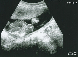 2013-05-15_ecografia 19 semanas.jpg